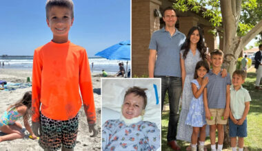 Nightmare California vacation for family as fire pit shoots flames at 8-year-old boy