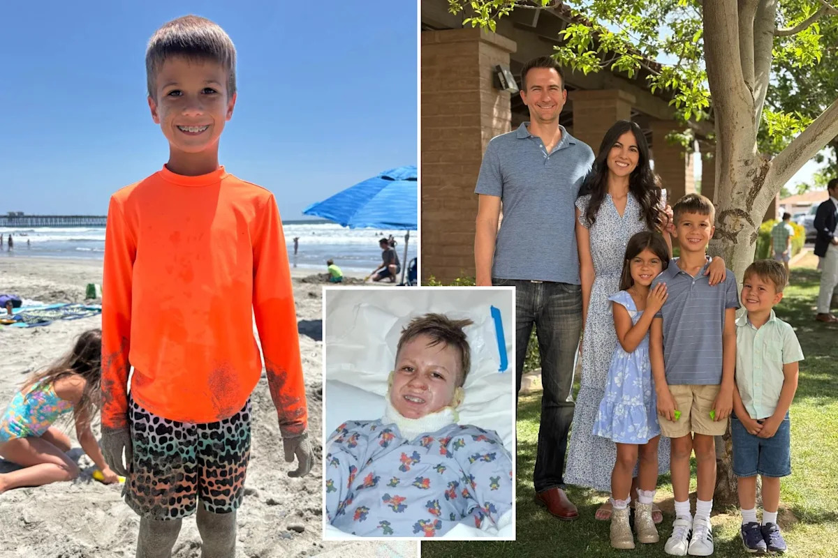 Nightmare California vacation for family as fire pit shoots flames at 8-year-old boy