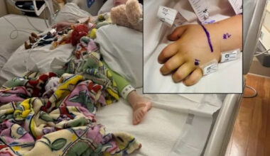Southern California girl, 3, bitten by rattlesnake hiding under Amazon package