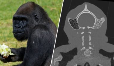 Gorilla gets surgery from UC San Diego, San Diego Zoo team says – NBC 7 San Diego