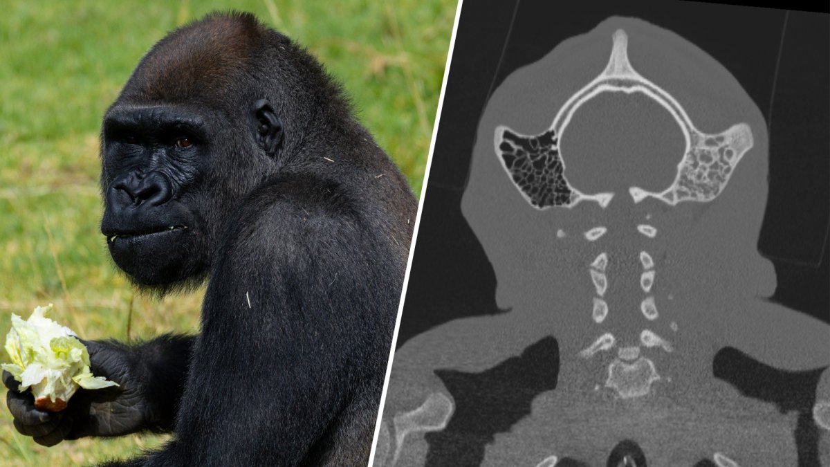 Gorilla gets surgery from UC San Diego, San Diego Zoo team says – NBC 7 San Diego