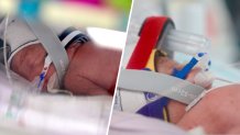 In these photo undated photos provided by Metro North Health hospital, two of the quadruplets are pictured in an incubator in Brisbane, Australia.