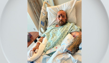 Man loses hand after explosion on California beach while picking up debris, family says