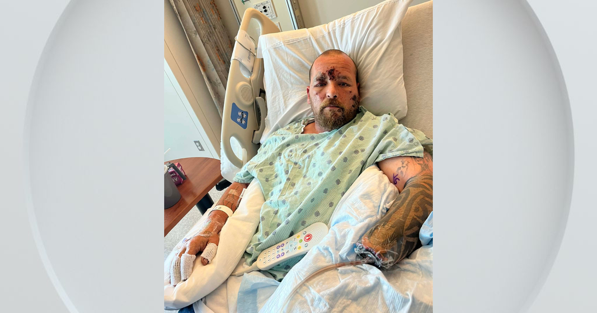 Man loses hand after explosion on California beach while picking up debris, family says