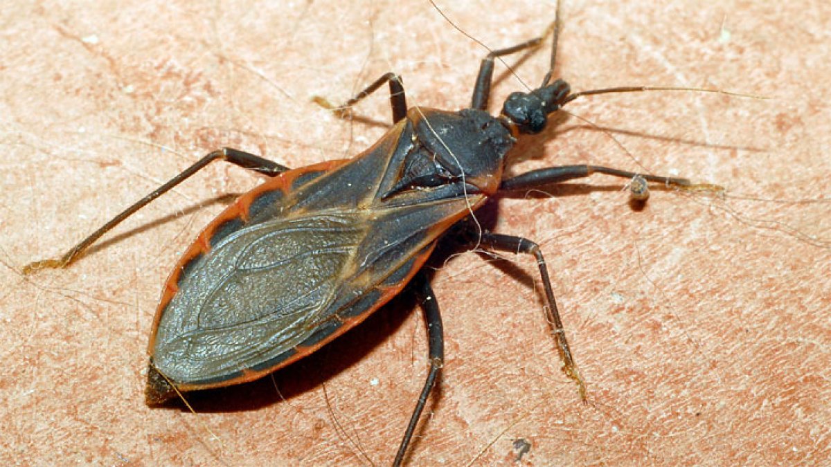 First locally acquired case of Chagas Disease reported in San Diego County – NBC 7 San Diego