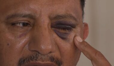 Long Beach ice cream vendor attacked on Fourth of July – NBC Los Angeles