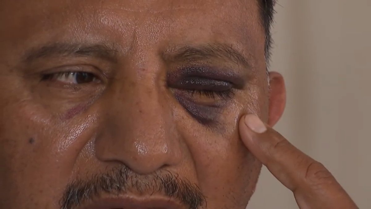 Long Beach ice cream vendor attacked on Fourth of July – NBC Los Angeles
