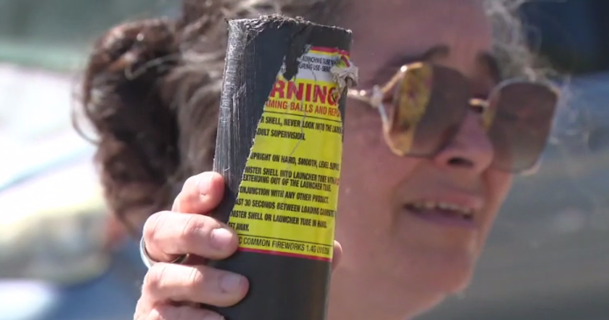 2 Orange County teens suffer life-altering injuries in Fourth of July fireworks accident