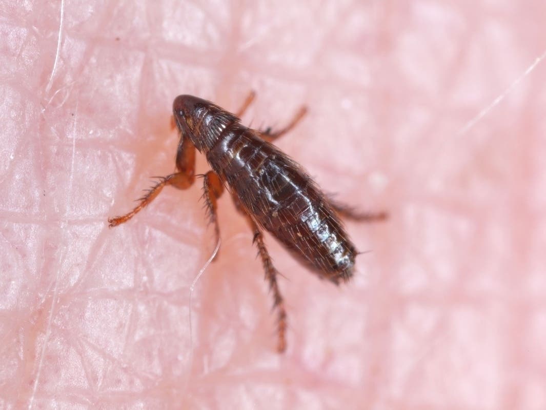 Typhus Cases Reach All-Time High As New Outbreak Sickens 5 In LA County