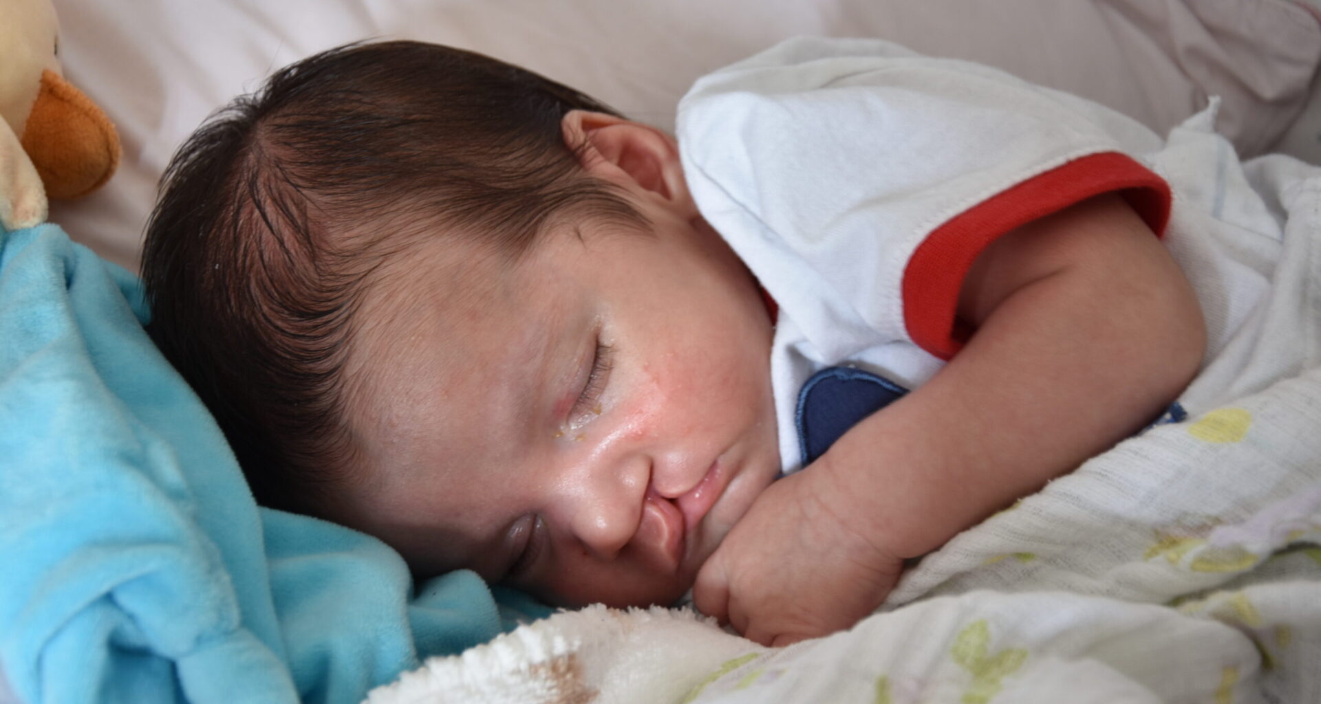 Faces of strength: The journey of children with cleft and craniofacial conditions • Brand stories