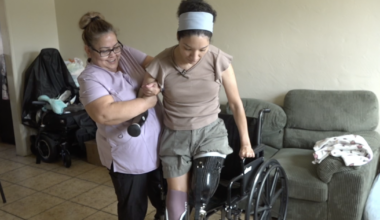 Logan Heights mom stands on prosthetic legs after flesh-eating disease battle