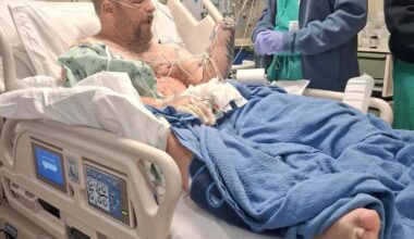 California man's hand blown off while cleaning up Fourth of July fireworks