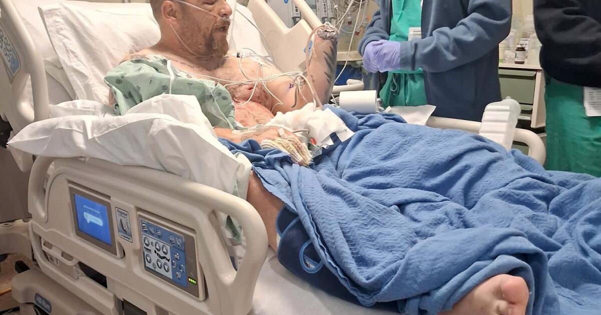 California man's hand blown off while cleaning up Fourth of July fireworks