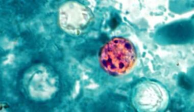 Cyclosporiasis hits 1,000 cases in U.S. What Californians should know
