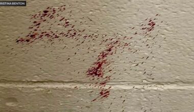 Lodi residents concerned with city park restrooms amid pictures of blood on walls, unsanitary conditions