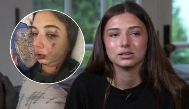 SoCal teen speaks out about e-bike dangers after recovering from life-threatening 2025 crash