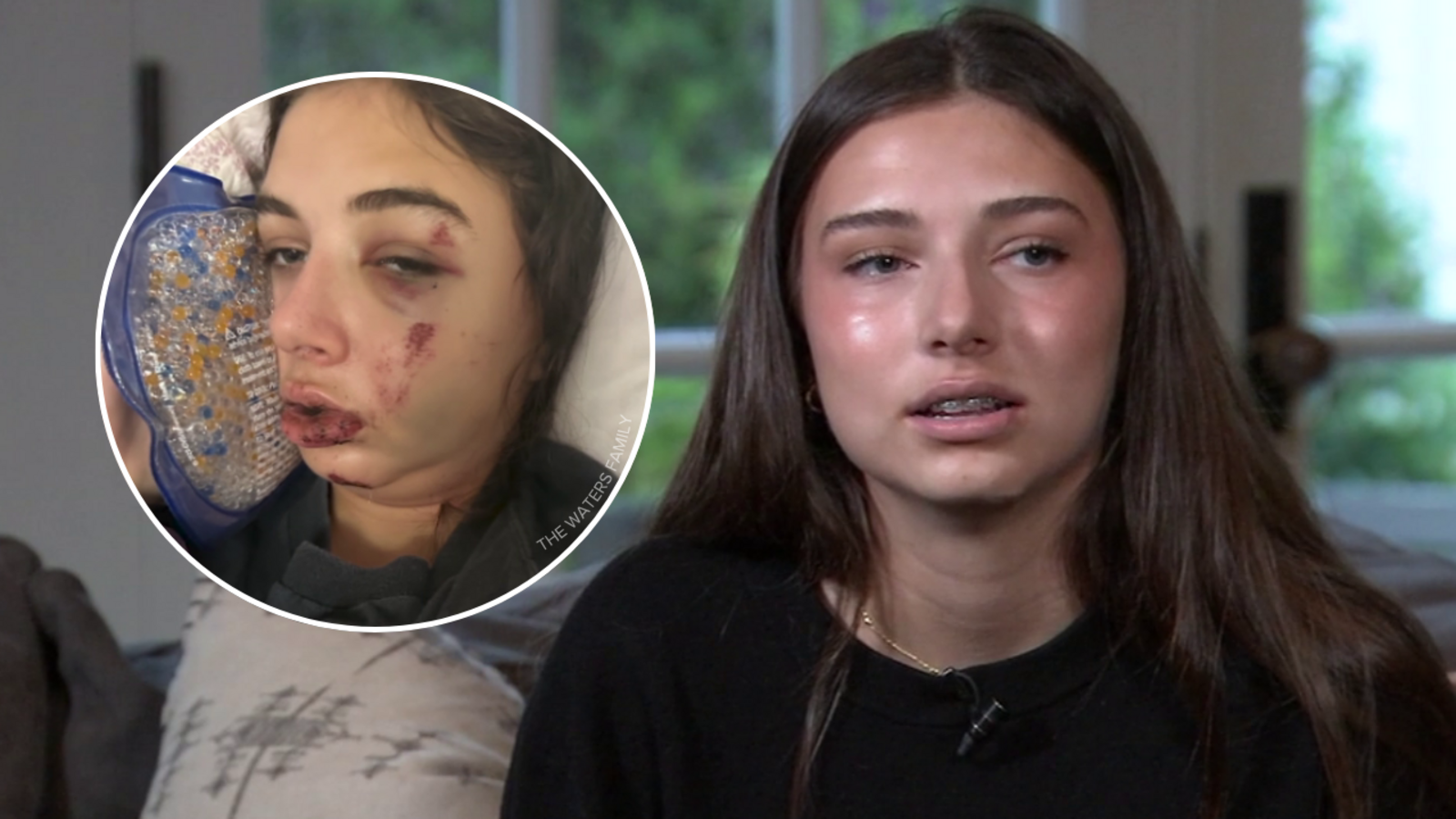 SoCal teen speaks out about e-bike dangers after recovering from life-threatening 2025 crash