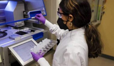 COVID-19 cases rise in California amid summer surge fears