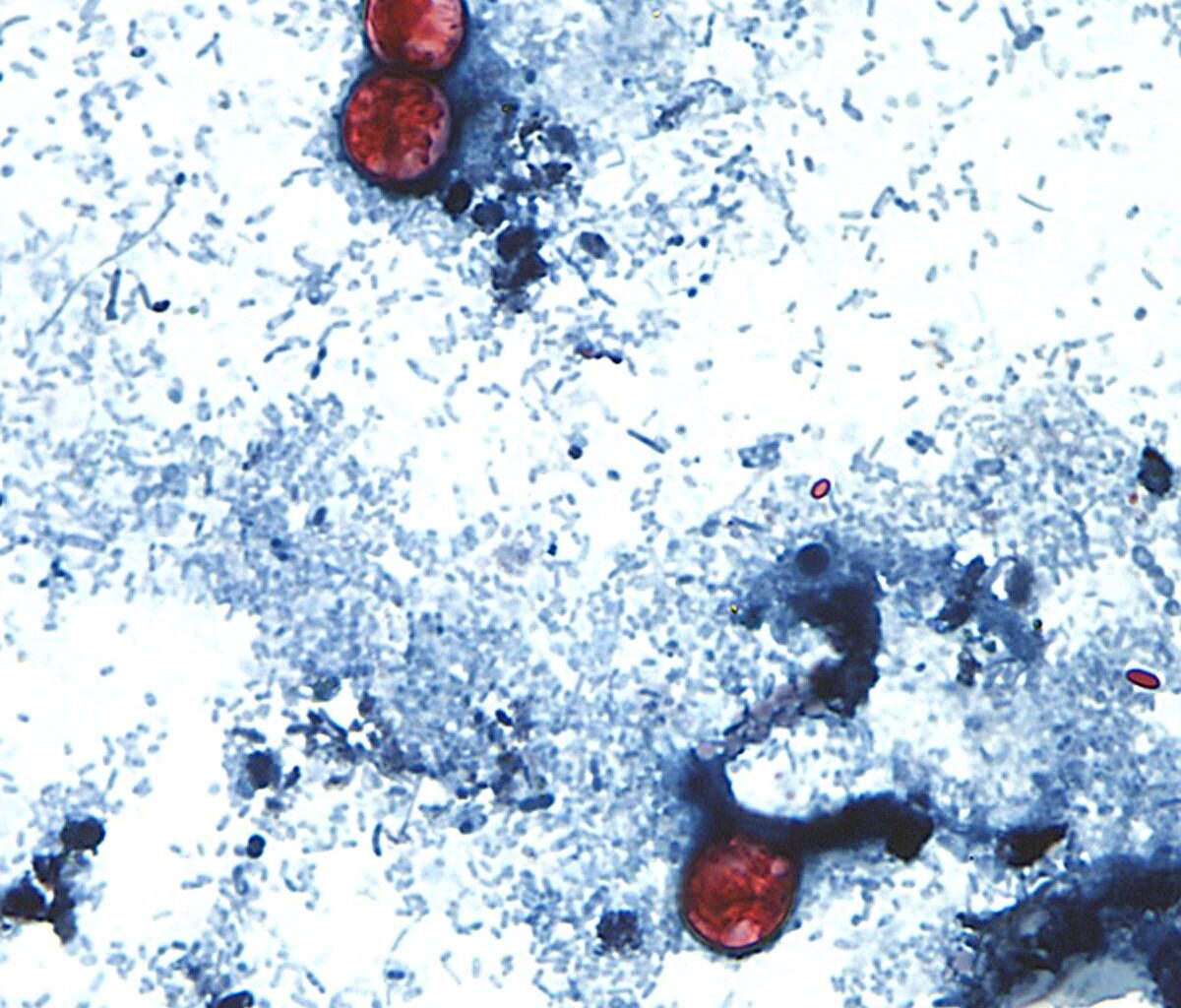 Michigan health officials report two deaths, parasite cases topping 11,000 – The Oakland Press