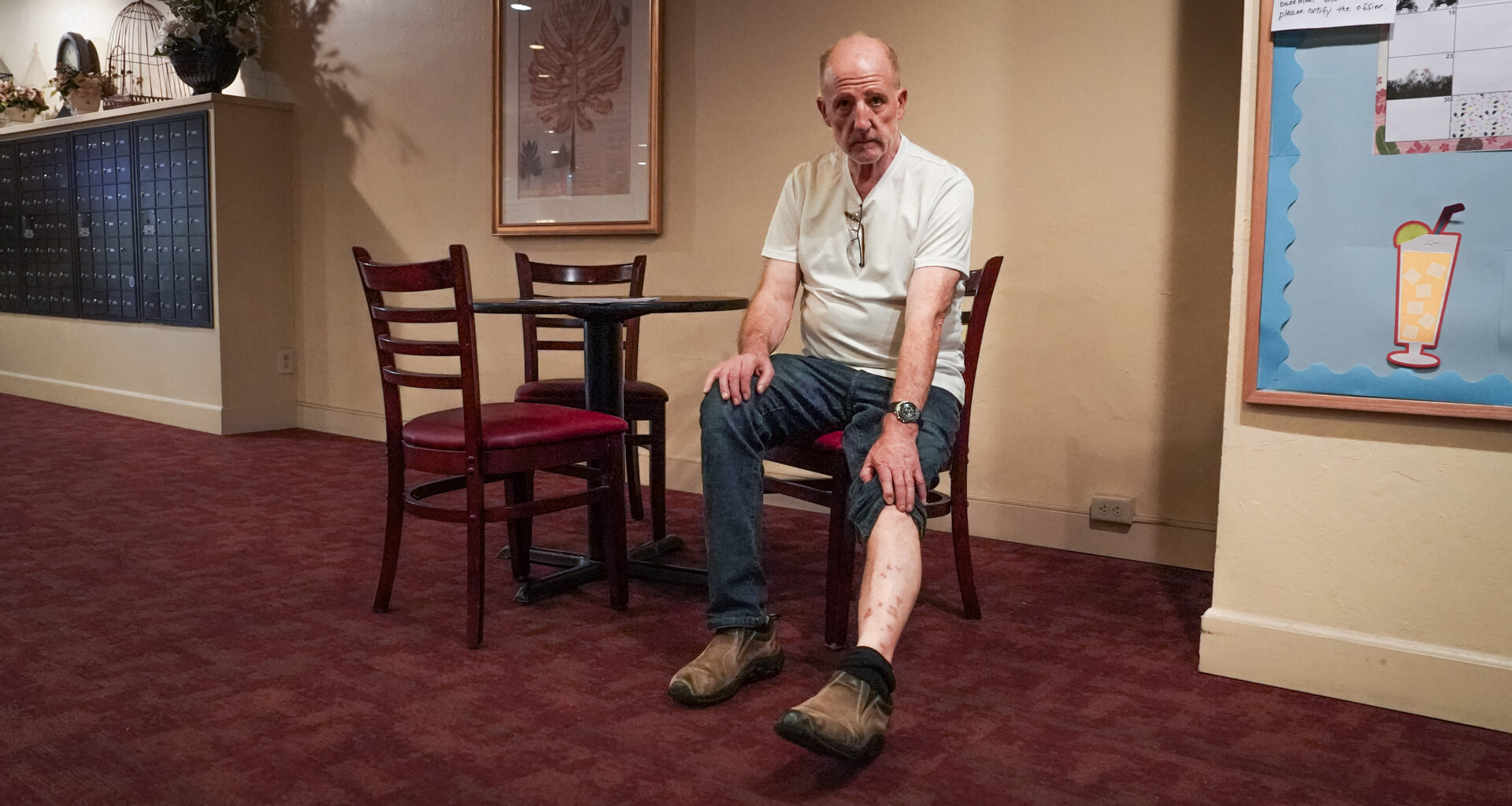 Man shows his leg