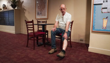 Man shows his leg