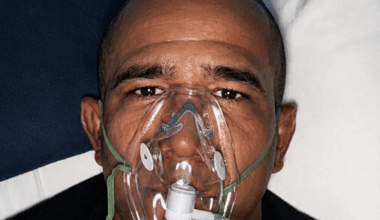 Gregory Rodrigues Reveals Herpes Outbreak Before UFC Fight
