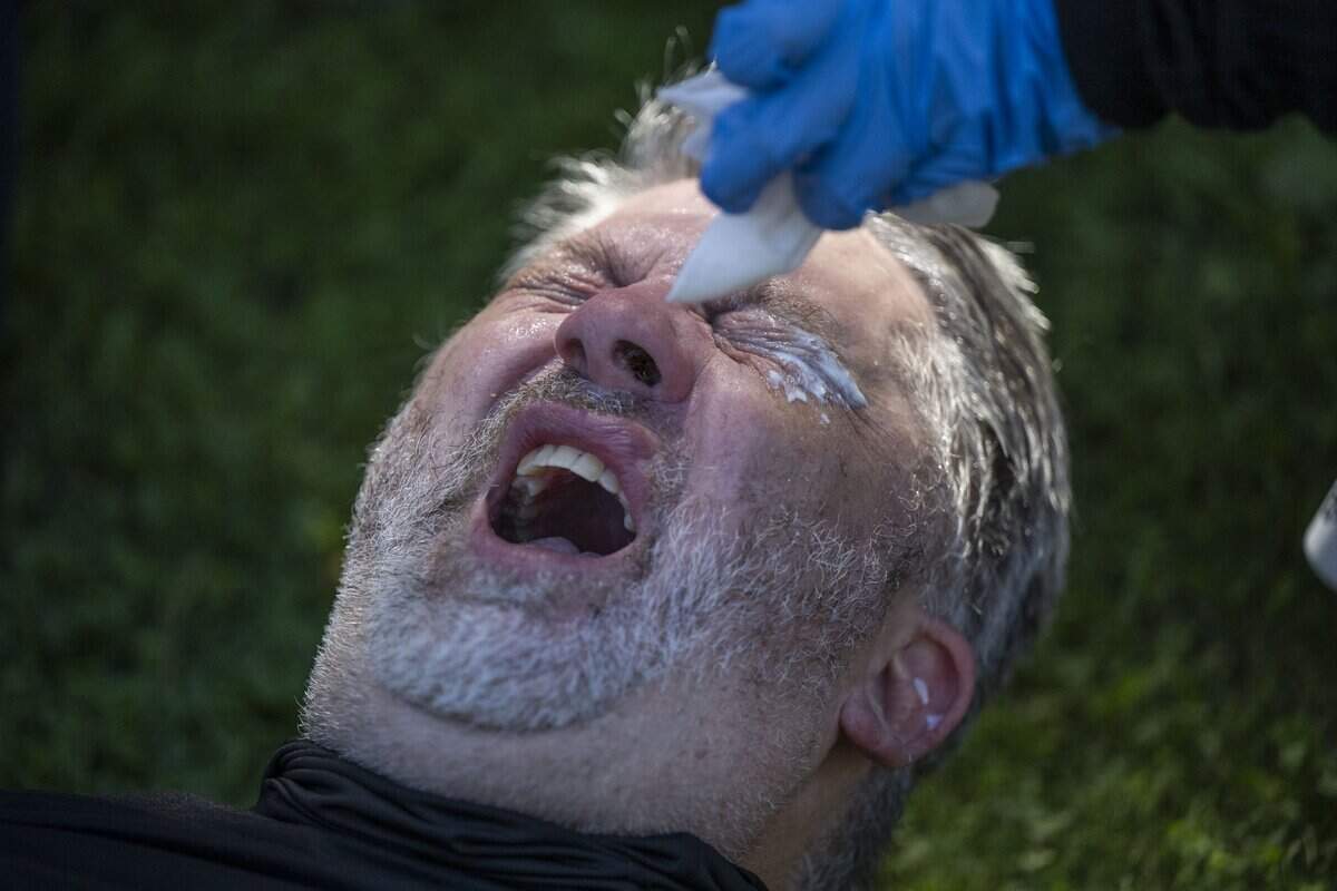 David Sypnieski, of Sacramento, is assisted after he was pepper-sprayed as he stood with a group protesting against conservative influencer Nick Shirley’s appearance at the state Capitol on Wednesday, Aug. 26, 2026.