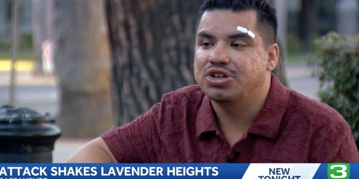 Police probe anti-LGBTQ+ beating in Sacramento