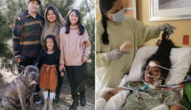 San Diego woman, 41, has arms and legs amputated after routine checkup went horribly wrong