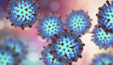 2nd Measles Case Reported In Orange County, Officials Advise Caution
