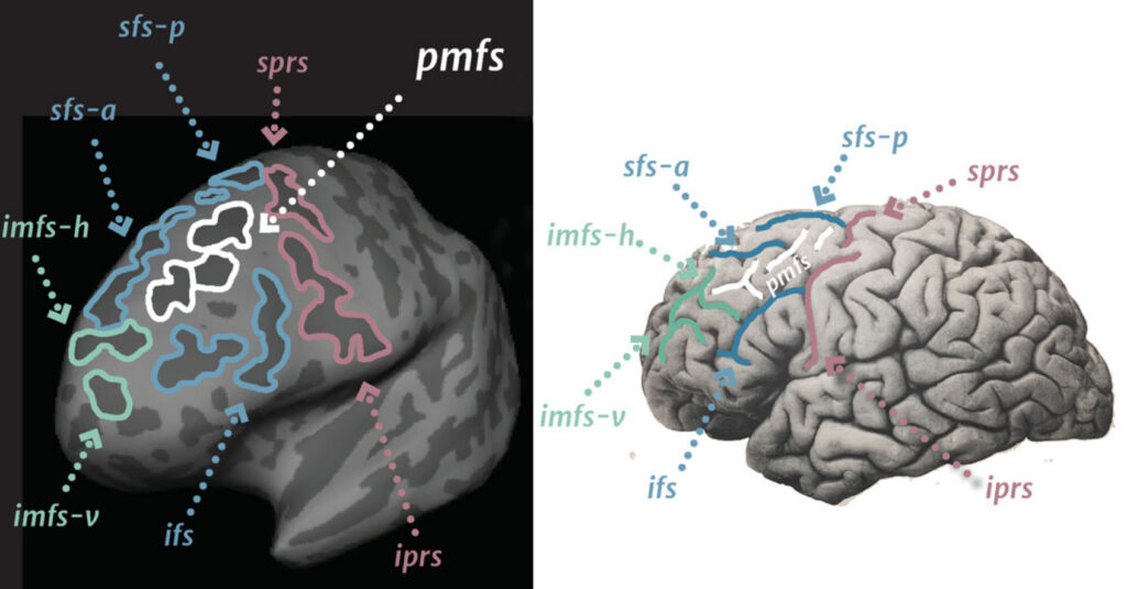 an MRI brain scan and photo of real human brain