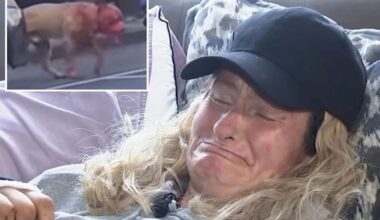 SF woman mauled by pit bull speaks out after surviving attack