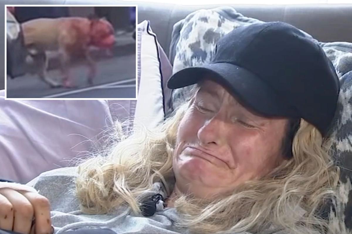 SF woman mauled by pit bull speaks out after surviving attack