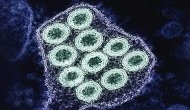 Rabies cases rising across California and the nation