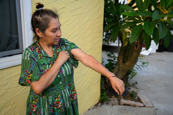 A woman with medium skin tone, wearing a green dress, shows a rash on her arm.
