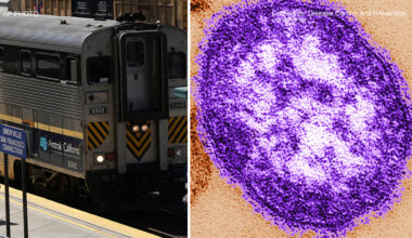 Health officials warning people about possible measles exposure across 6 California counties including Emeryville Amtrak Station