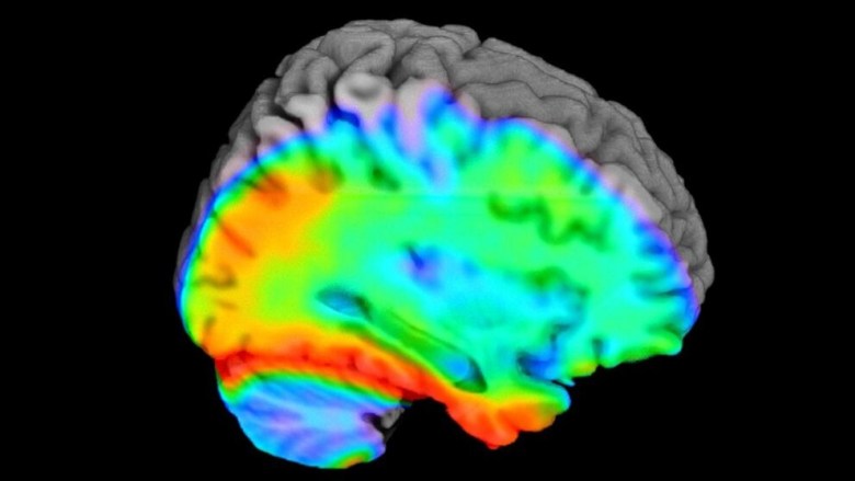 Brain scan