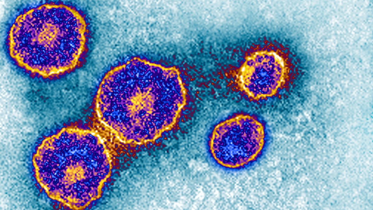 SDSU football team confirms 14 cases of mumps – NBC 7 San Diego
