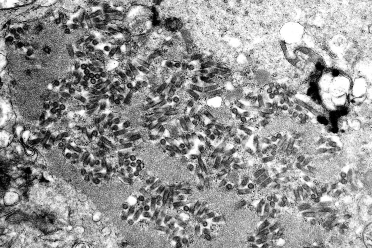 This undated electron microscope image made available by the Centers for Disease Control and Prevention shows rabies virions, dark and bullet-shaped, within an infected tissue sample.