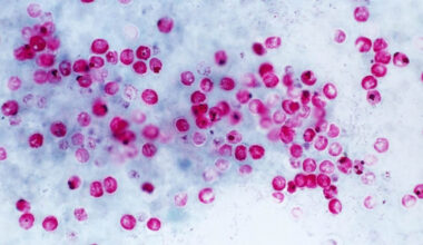 Crypto parasite under the microscope