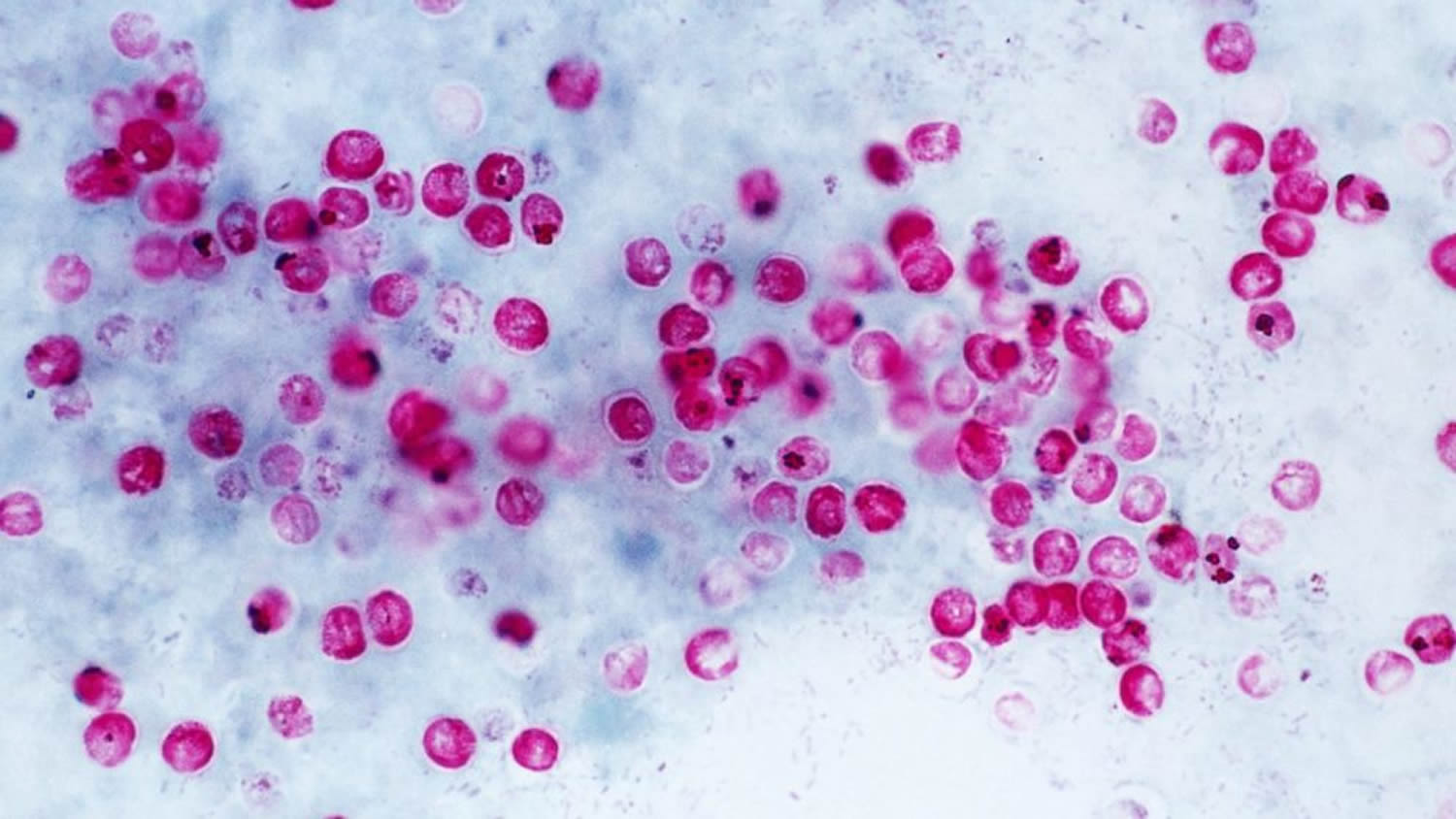 Crypto parasite under the microscope