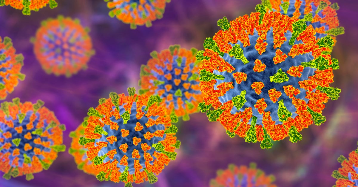 California warns unvaccinated person with measles traveled through 6 counties