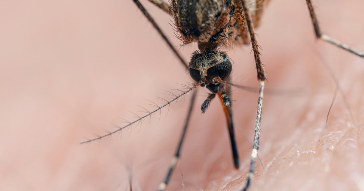 Oakland County detects first probable human case of West Nile virus in 2026