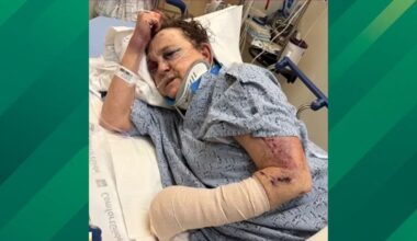 California Grandmother Welcomes a Stranger Home, Found Beaten 6 Days Later