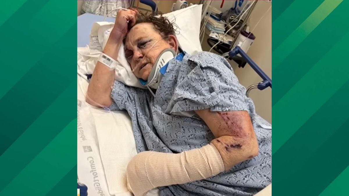 California Grandmother Welcomes a Stranger Home, Found Beaten 6 Days Later