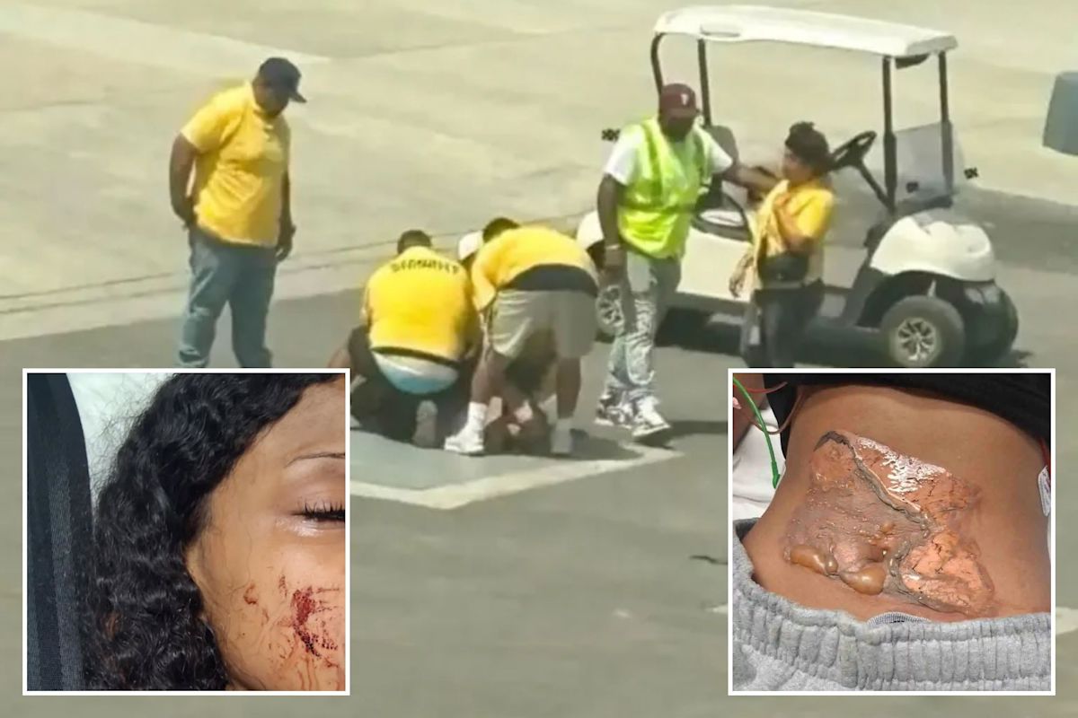 Bakersfield girl, 14, left with horrific injuries after security pinned her on scorching ‘electric’ plate