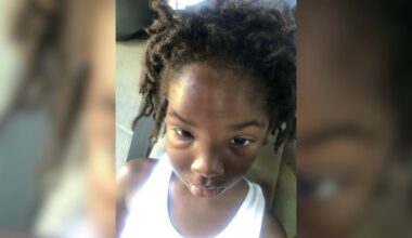 Bakersfield mom shocked after child returns with injuries from school, demands answers