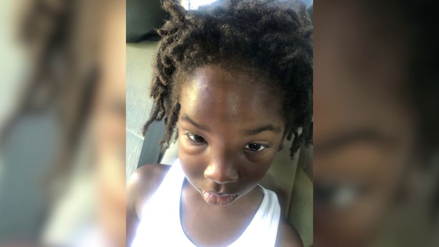 Bakersfield mom shocked after child returns with injuries from school, demands answers