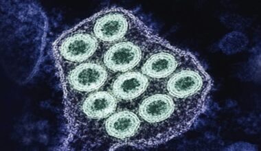 Sacramento news: Rabies alert, cheese recall and Rancho Cordova traffic changes