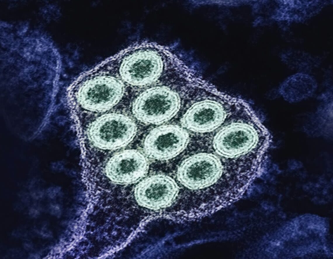 Sacramento news: Rabies alert, cheese recall and Rancho Cordova traffic changes